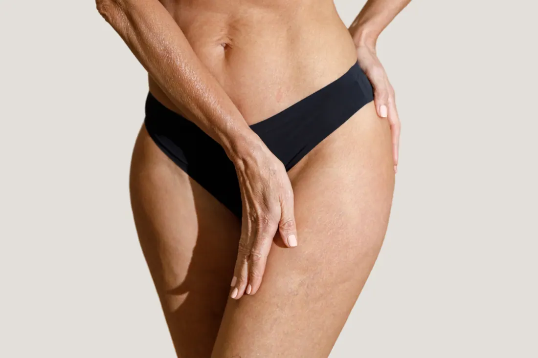 Cirurgia Íntima